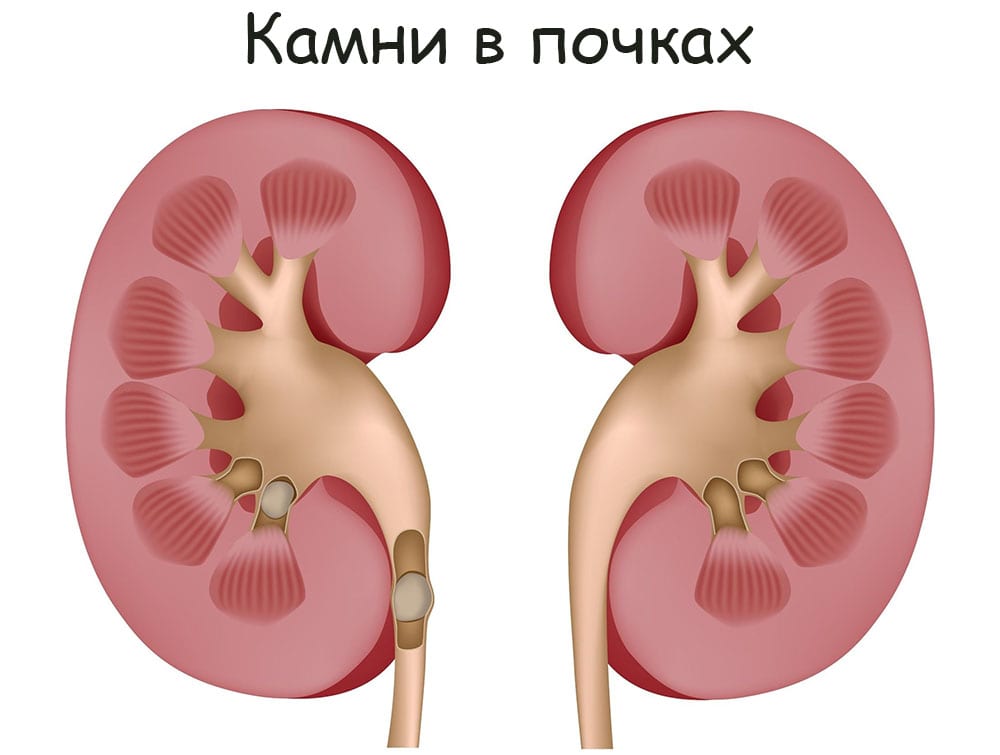 Кракен нарк